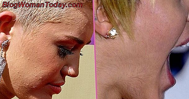 Comment Eclaircir Les Poils Du Visage Naturellement Beaute